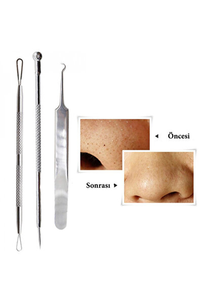 shopwave Stainless Steel Blackhead and Acne Cleaner Set of 3