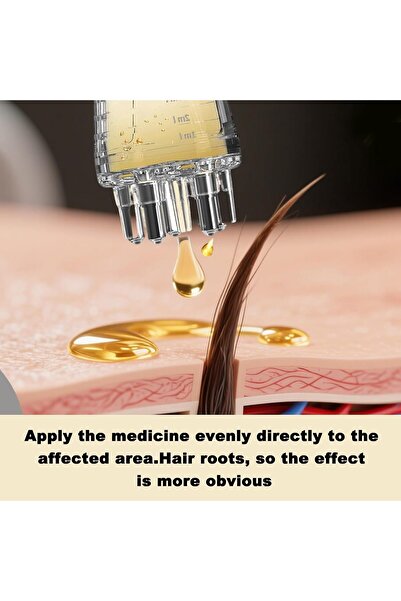 Yelajoy 2PCS Hair Oil Applicator & Scalp Massager,Scalp Massage Comb with Roller Ball,Twist-On Top Tip Cap