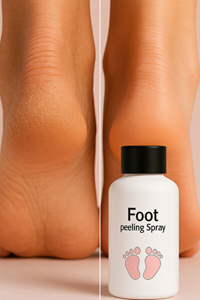 Puredermine Ayak Peeling jeli – Topuk Çatlaklarına Karşı Etkili – Ölü Deri So...