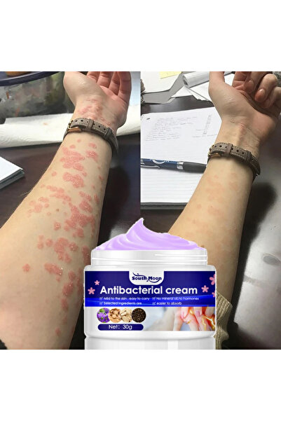 South Moon كريم مضاد للبكتيريا - حماية سريعة المفعول من الجراثيم، وتلطيف البش...