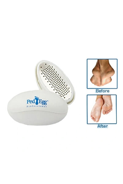 Arthurs ملف كعب بيضة بيد