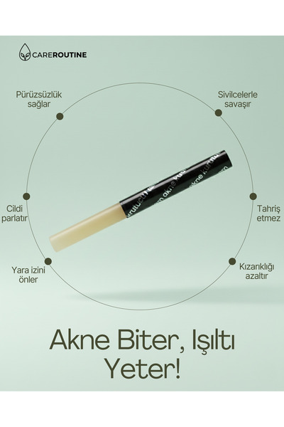 Locci's Kalemi