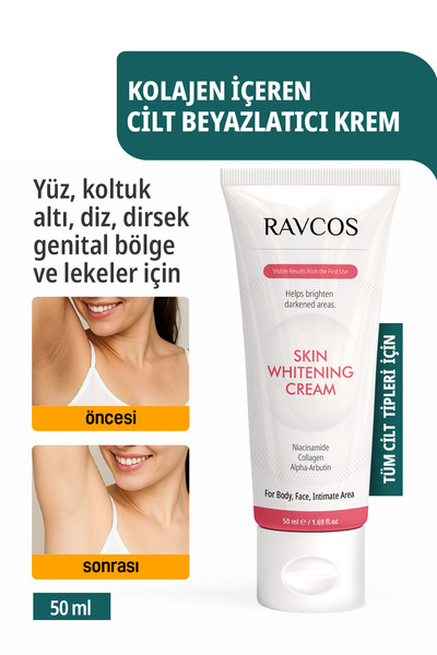 Ravcos Cilt Beyazlatıcı Krem – Yüz, Genital Bölge, Koltuk Altı, Diz ve Dirsek...