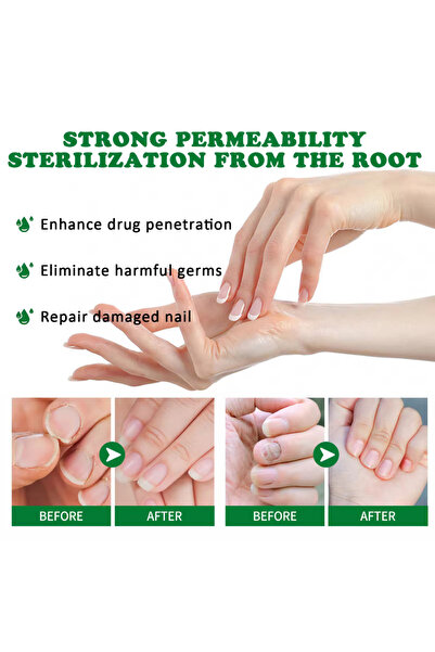 jaysuing 7 Days Nail Treatment Serum – Anti-Fungal Nail Repair Lotion for Damaged, Cracked 3 pcs