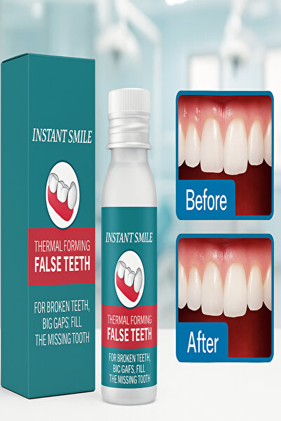 ESENLİWE Takma Diş Kırık Diş Tamiri, Diş Boşluk Doldurma, Eksik Diş Kapama, I...