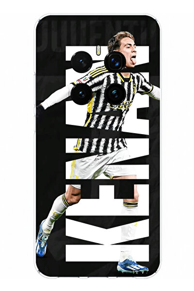 TechTree حافظة سيليكون متوافقة مع هاتف Honor Magic 7 PRO من Kenan Yıldız Sevi...