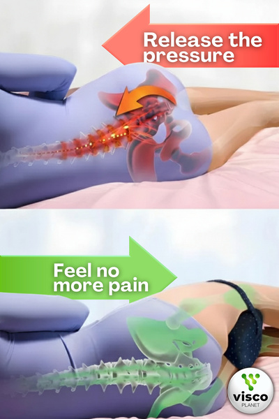 Visco Planet Ortopedik Bacak Arası Yan Yatış Yastığı Ergonomik Uyku Minderi Lastikli