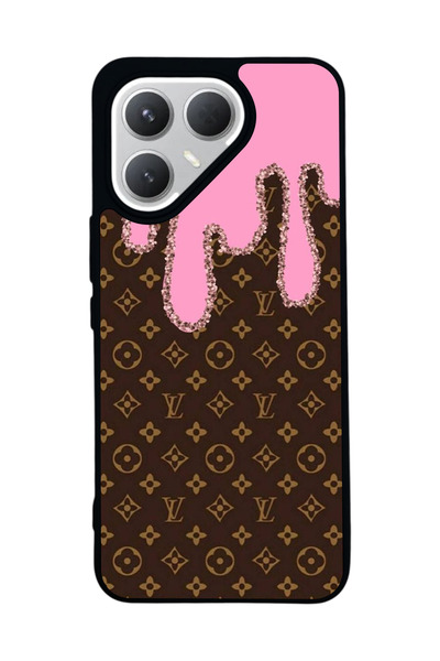 TECNO حافظة سوداء متوافقة مع هاتف Pova 7 Pro – سيليكون ناعم، واقي، غطاء ممتص للصدمات