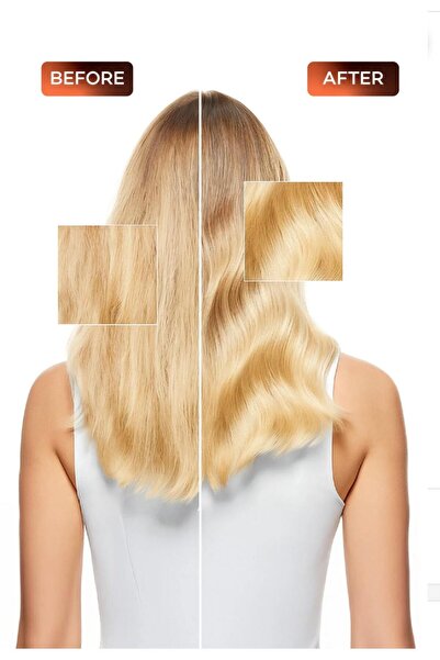 ERASTE سيروم العناية بالشعر الذي يسرع نمو الشعر 50 مل