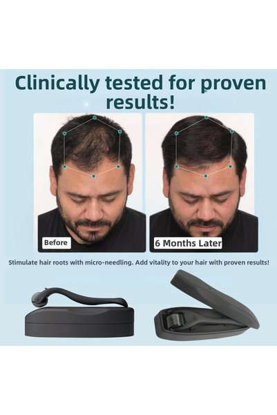 Dermotik Titanium Tip 540 Needle Hair Beard Removal and Skin Care Dermaroller Massage Tool 1 mm