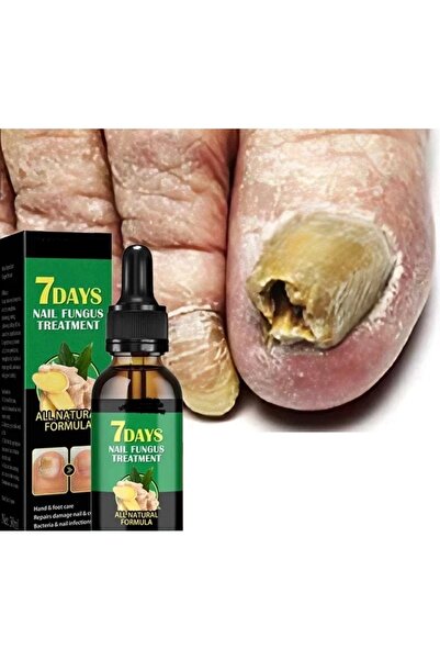jaysuing 7 Days Nail Treatment Serum – Anti-Fungal Nail Repair Lotion for Damaged, Cracked 3 pcs