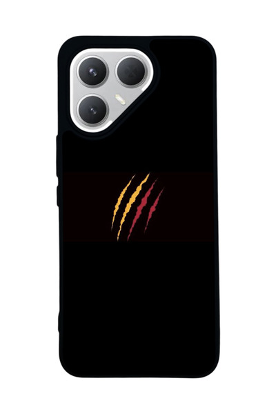 TECNO Pova 7 Pro Mat Uyumlu Siyah Kılıf – Yumuşak Silikon, Koruyucu, Şok Emic...