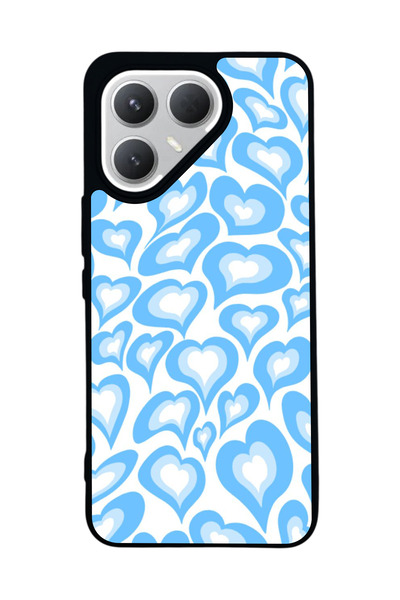 TECNO حافظة سوداء متوافقة مع هاتف Pova 7 Pro – سيليكون ناعم، واقي، غطاء ممتص للصدمات