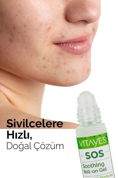 VITAYES Sos Serum Siyah Nokta Akne Sinek Isırması Cilt Problemi Onarıcı Çay Ağacı Yağı Cilt Serumu 30 ml