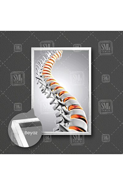 SML TABLO Omurga Sağlığı Beyin Ve Sinir Cerrahisi Spine Çerçeveli Dikey Kanva...