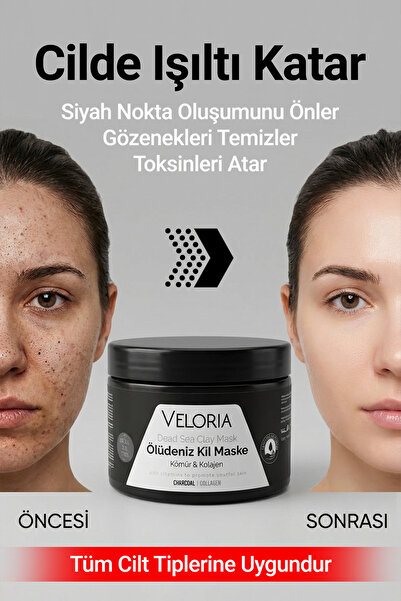 Veloria Cosmetics Gözenek Sıkılaştırıcı Yaşlanma Ve Siyah Nokta Leke,giderici...