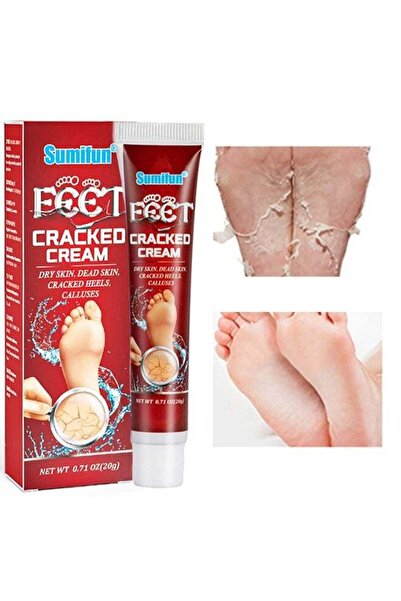 SUMIFUN كريم لتشققات القدمين 20 جرام - كريم مرطب ومصلح لتشققات القدمين واليدين