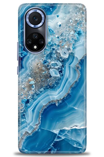 Rulet Aksesuar غطاء متوافق مع هاتف هواوي نوفا مطبوع HD - غطاء سيليكون مصمم - 317