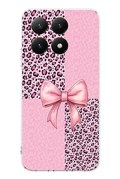 TechTree حافظة سيليكون متوافقة مع هاتف Xiaomi Mi 15T PRO بنمط الفهد الوردي وش...