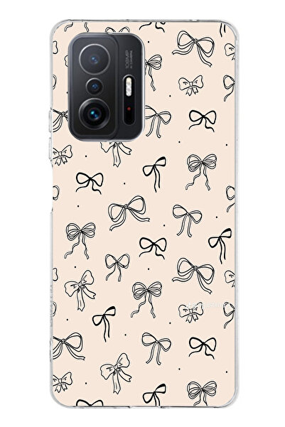 TechTree حافظة سيليكون متوافقة مع هاتف Xiaomi Mi 11T-11T PRO باللون الأسود ون...