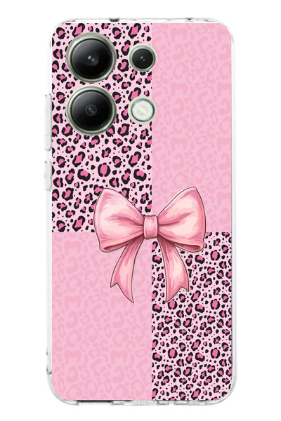 TechTree حافظة سيليكون متوافقة مع هاتف Redmi Note 13 4G بنمط الفهد الوردي وشر...