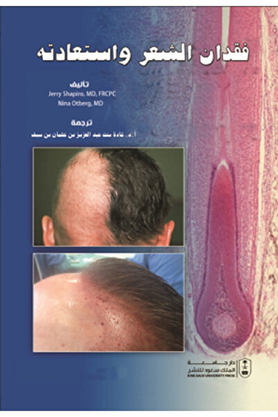 Book Hair loss and recovery by: Jerry Shapiro, Nina Otberg,