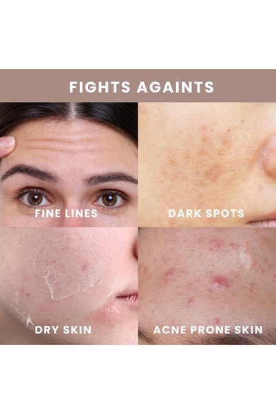 PIME Niacinamide Cream 50g x2 | Anti-Aging Moisturizer for Acne-Prone Skin & Dark Spots