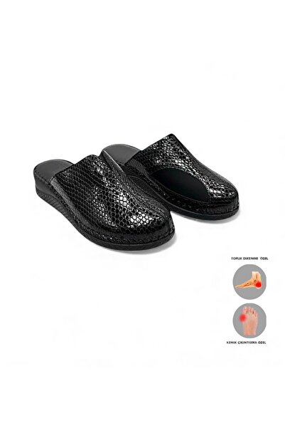 MİRATERLİK ORTOPEDİK TERLİK VE AYAKKABI نعال ميرا الطبية سايبا مريحة للغاية لعلاج تشوه إصبع القدم الكبير ونتوء العظام ونتوءات الكعب