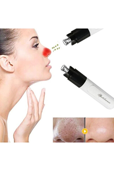 CRM SpotCleaner Vacuum Device, CRM, Pore Cleaning, Blackhead Removal, Skin Care, Black-White