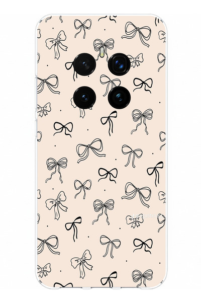 TechTree حافظة سيليكون متوافقة مع هاتف Honor Magic 7 PRO باللون الأسود ونمط ا...