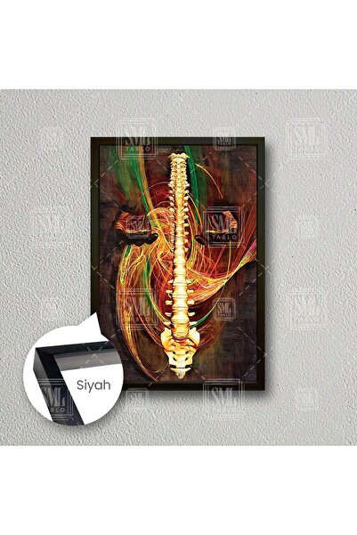SML TABLO Omurga Sağlığı Beyin Ve Sinir Cerrahisi Soyut Tasarım Çerçeveli Dik...