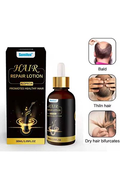 SUMIFUN لوشن طبيعي عضوي لإصلاح الشعر المصاب بالثعلبة، عبوة واحدة سعة 30 مل