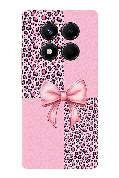 TechTree حافظة سيليكون متوافقة مع هاتف Redmi Note 14 PRO 5G بنمط الفهد الوردي...