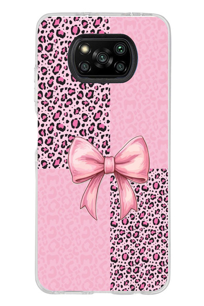 TechTree حافظة سيليكون متوافقة مع Poco X3-X3 PRO-NFC بنمط الفهد الوردي وشريط ...