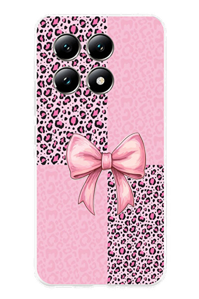 TechTree حافظة سيليكون متوافقة مع هاتف Xiaomi Mi 14T PRO بنمط الفهد الوردي وش...