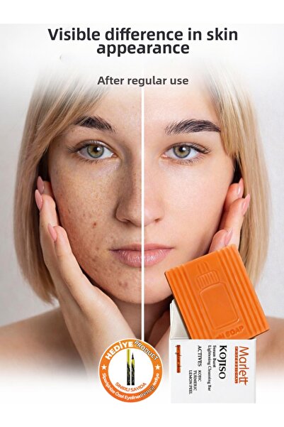 Güzellik Deposu صابون pH – صابون يحتوي على حمض الكوجيك والكركم وقشر الليمون، ...