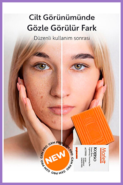 GXMPRO pH Sabunu – Leke ve Kışıklıklık Karşıtı Kojik Asit, Zerdeçal ve Limon ...