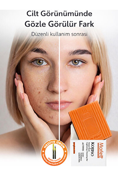 Güzellik Deposu pH Sabunu –Akne, Leke ve Kışıklıklık Karşıtı Kojik Asit, Zerd...