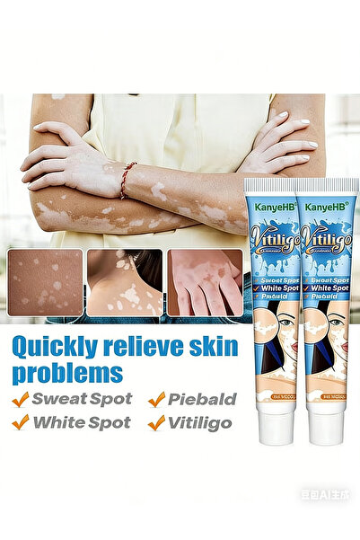 KanyeHB مرهم البهاق، علاج البهاق للبشرة، تحسين تصبغ الجلد 20 غرام