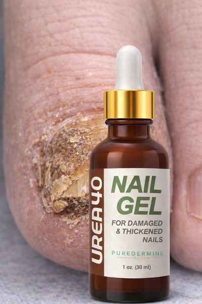 Puredermine Kalınlaşmış Tırnak İçin %40 Üre Jel 30 ml | Tırnak İnceltme & Boz...