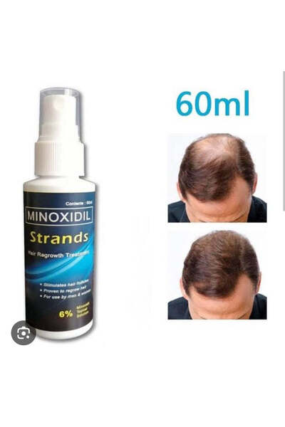 Minoxil علاج مينوكسيديل ستراندز 6% لإعادة نمو الشعر