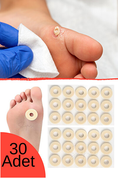Shopura Nasır Önleyici Koruyucu Yastık - 30 Adet Yumuşak Sünger Nasır Halkası