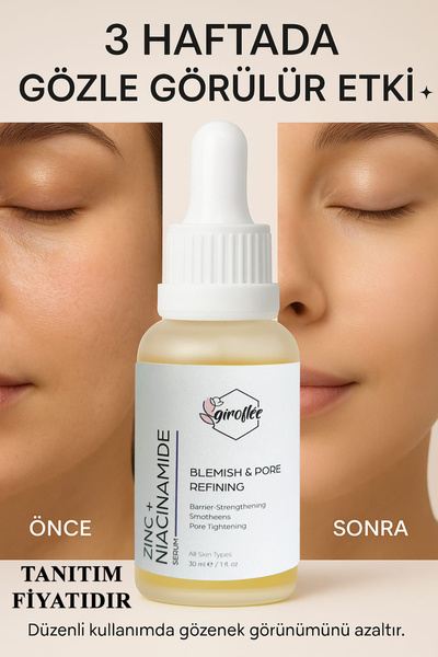 shop Zinc + Niacinamide Serum 30 ml – Gözenek Sıkılaştırıcı, ve Leke Karşıtı ...