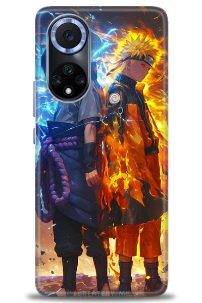 Rulet Aksesuar غطاء متوافق مع هاتف هواوي هونر 50 HD مطبوع + واقي شاشة سيراميك...