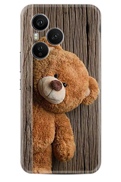 Arvencase حافظة هونر 400 برو مطبوع من السيليكون عالي الحماية بنمط kak stk-104...