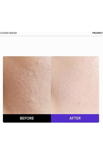 FRANKLY سيروم كلوزر - 9 ببتيدات وكولاجين نباتي، مصغر للمسام ومضاد للشيخوخة، م...