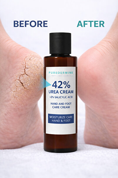Puredermine Çatlak Topuklara Etkili Çözüm | %42 Urea + %2 Salisilik Asit Yoğu...