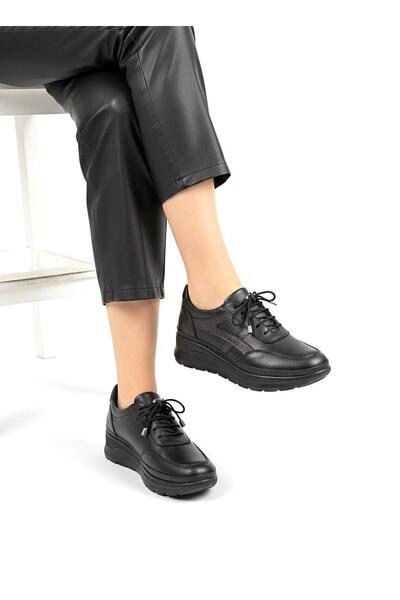 MİRATERLİK ORTOPEDİK TERLİK VE AYAKKABI Mira Orthopedic Women's Leather Shoes...