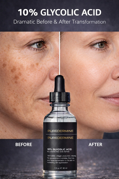 Puredermine %10 Glikolik Asit Serum – Gözenek Sıkılaştırıcı, Leke Karşıtı, Ci...