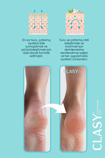 Clasy Care Ayak Ve Topuk Çatlak Kremi, Ayak Bakımı, Ayak Kokusu Ve Topuk 100ml 2 li